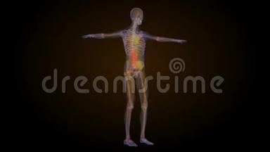 下背部脊柱疼痛的X线骨架动画